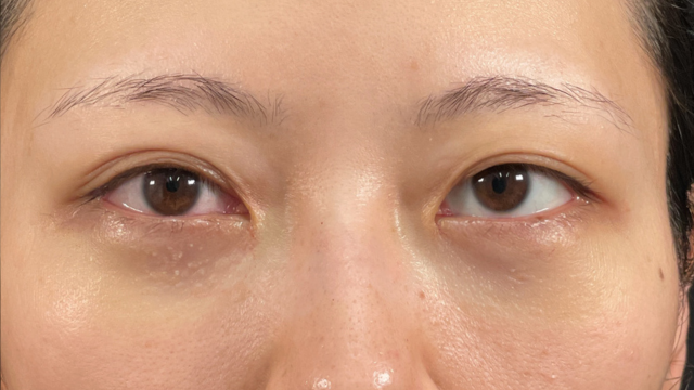 手术前的状态 其一