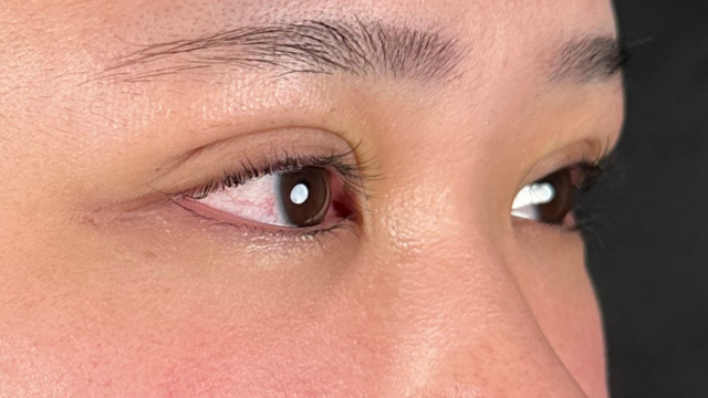 手术前的状态 其一