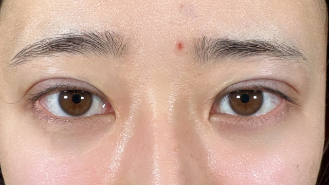 手术前的状态 其一