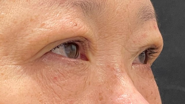 手术前的状态 其一