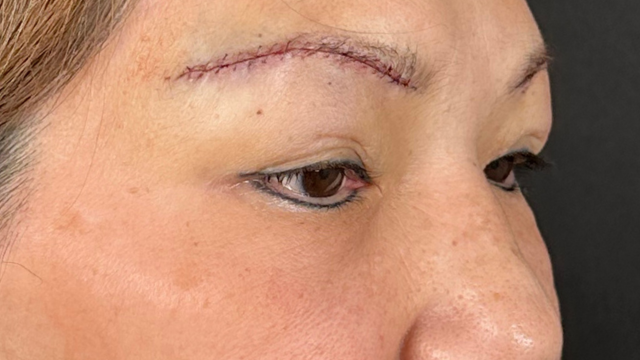 Postoperative Condition Part 1