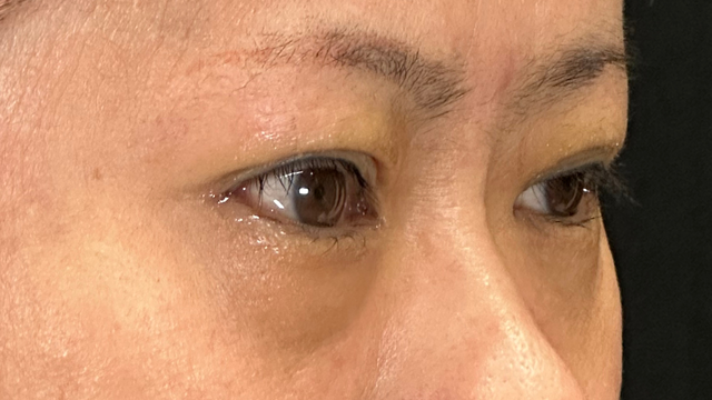 Postoperative Condition Part 1