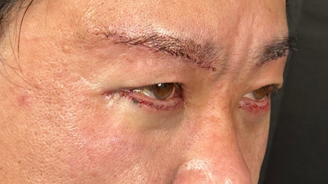 Postoperative Condition Part 1