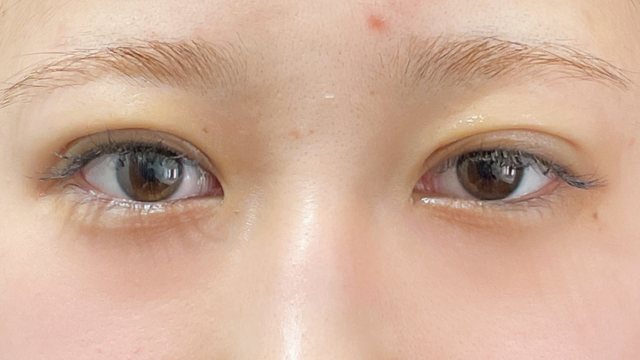 手术前的状态 其一