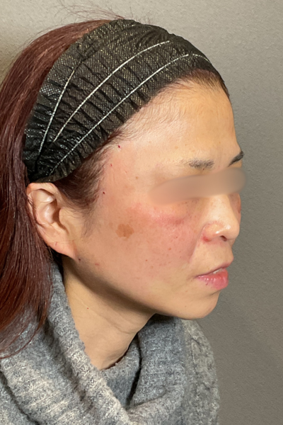 Postoperative Condition Part 1