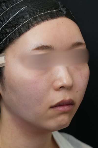 手術前の状態 その1