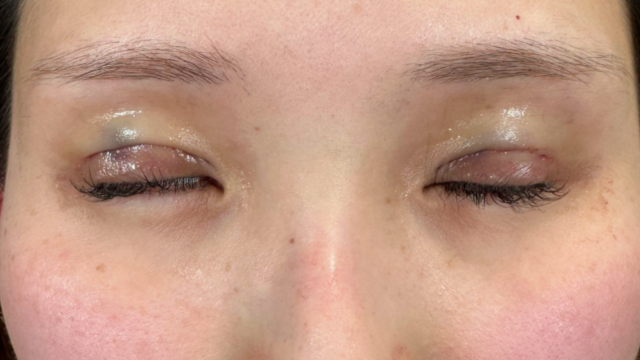 手术前的状态 其一