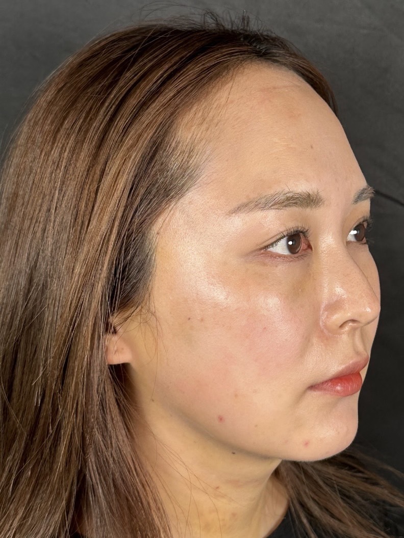 手术前的状态 其一