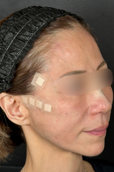 手術前の状態 その1