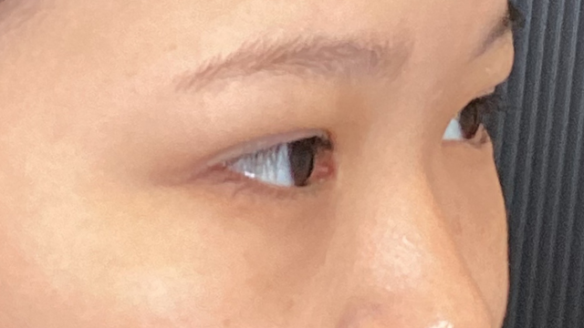 Postoperative Condition Part 1