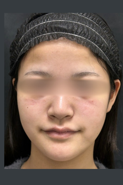 手術前の状態 その1