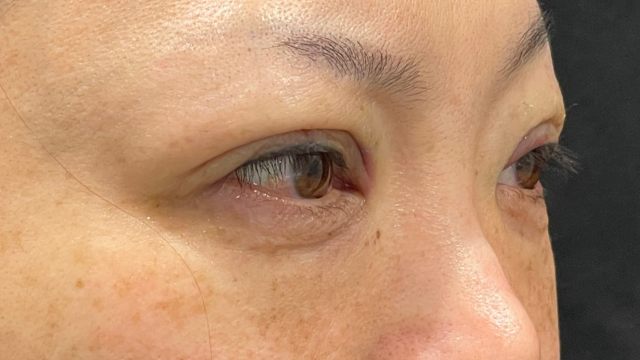 手術前の状態 その1