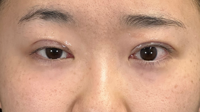 Postoperative Condition Part 1