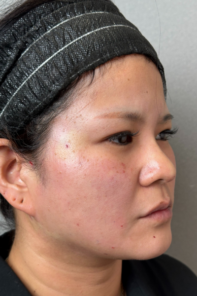 Postoperative Condition Part 1