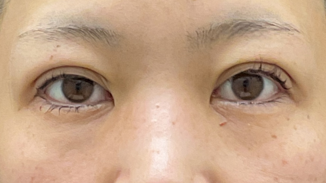 手术前的状态 其一