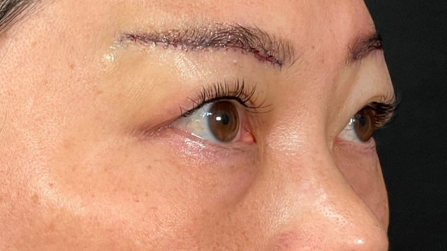 Postoperative Condition Part 1