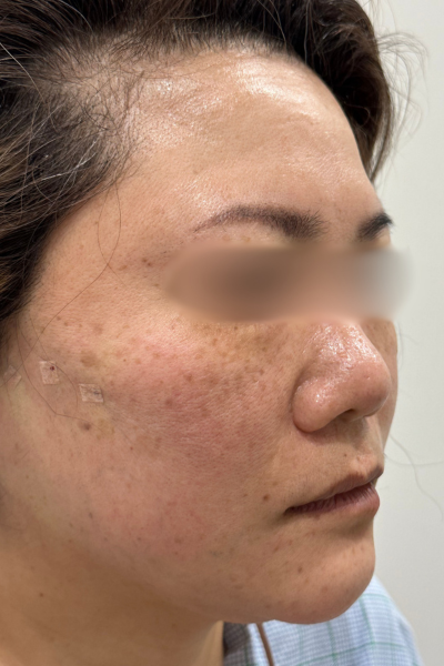 手術前の状態 その1