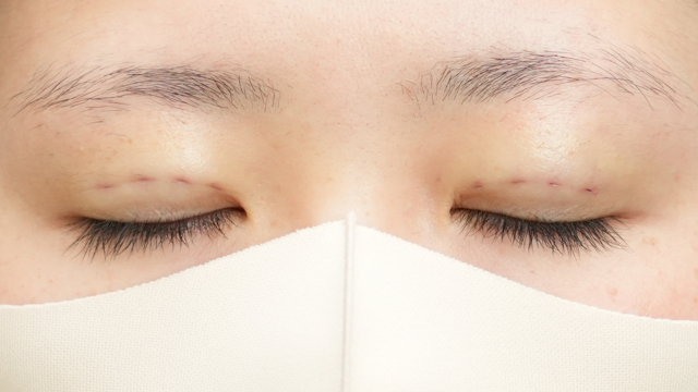 手术前的状态 其一