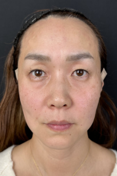 手术前的状态 其一