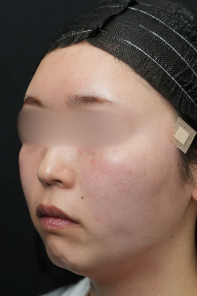 Postoperative Condition Part 1