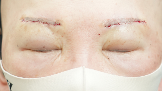 Postoperative Condition Part 1