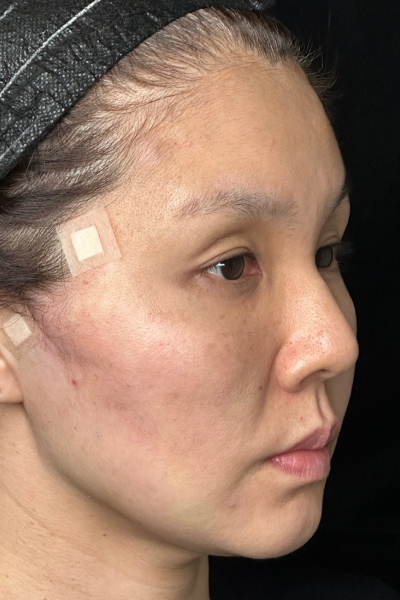 手術前の状態 その1