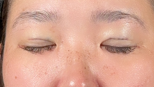 手术前的状态 其一