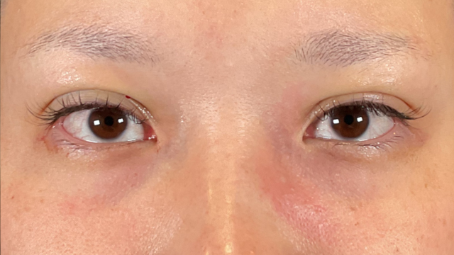 Postoperative Condition Part 1