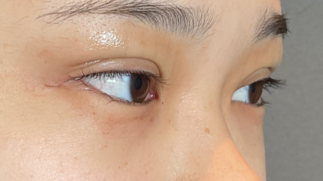 手术前的状态 其一