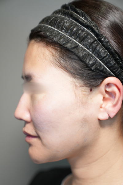 手術前の状態 その1