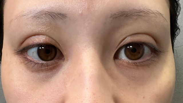 手术前的状态 其一