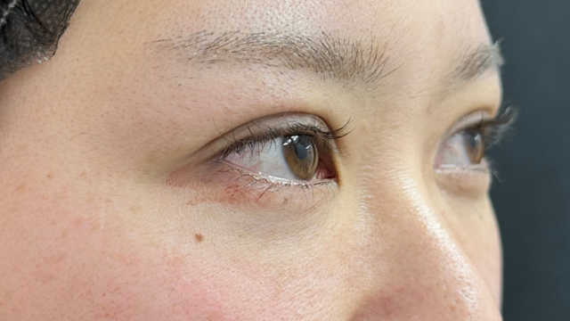 手术前的状态 其一