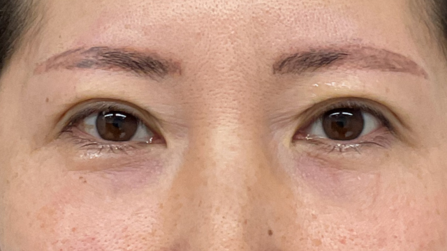 Postoperative Condition Part 1