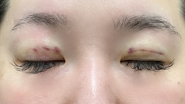 Postoperative Condition Part 1