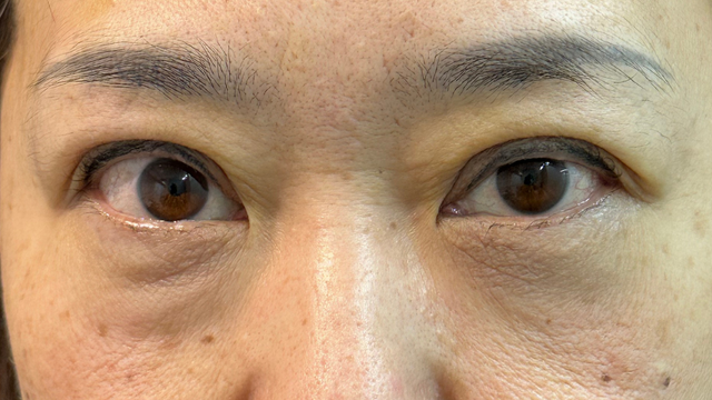 Postoperative Condition Part 1