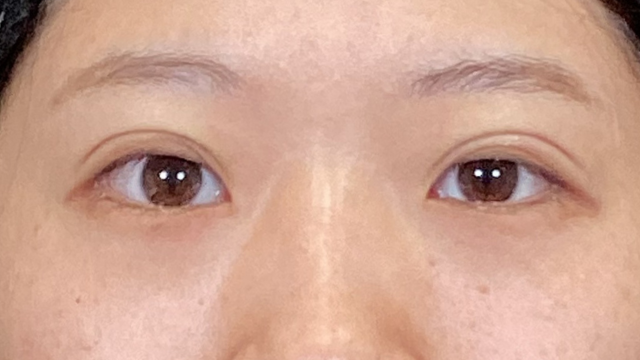 手术前的状态 其一