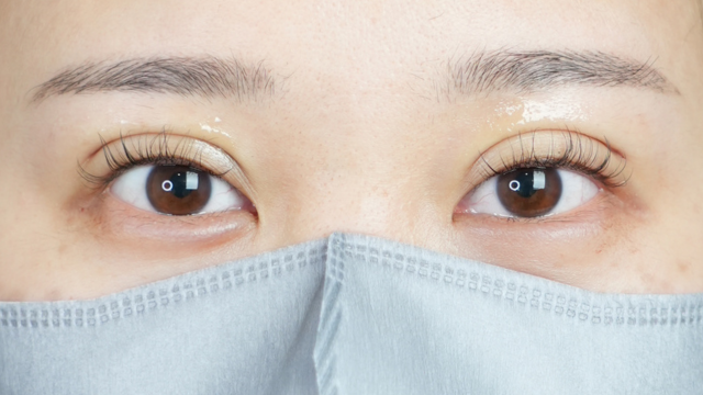 手術前の状態 その1