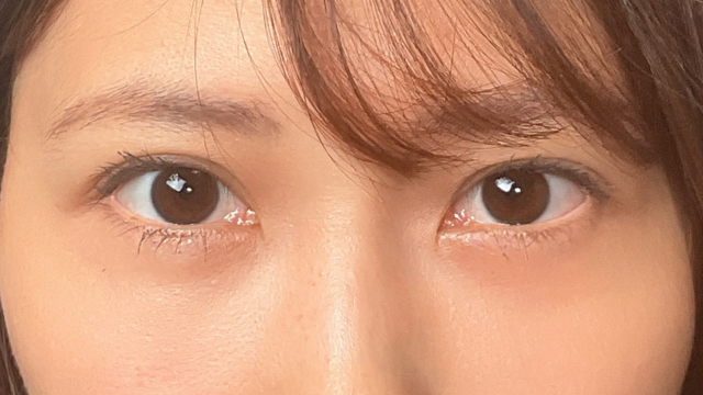 Postoperative Condition Part 1