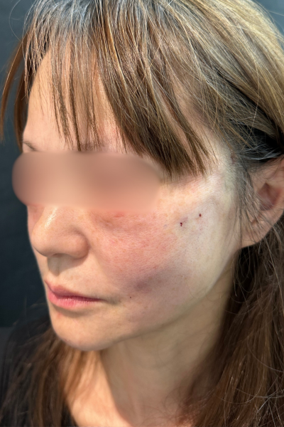 手術前の状態 その1