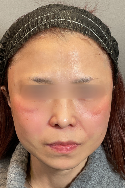 Postoperative Condition Part 1