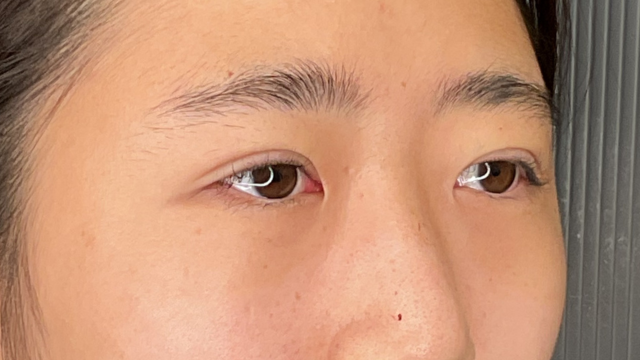 Postoperative Condition Part 1