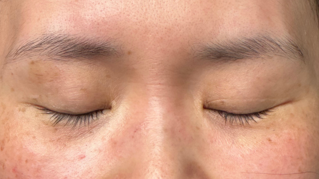 手術前の状態 その1