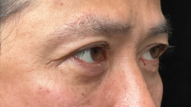 手术前的状态 其一