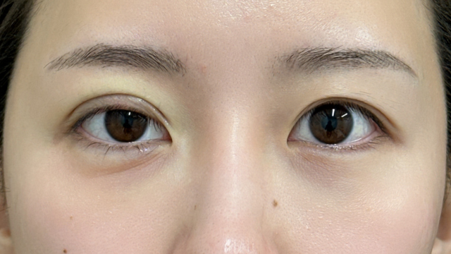 手术前的状态 其一