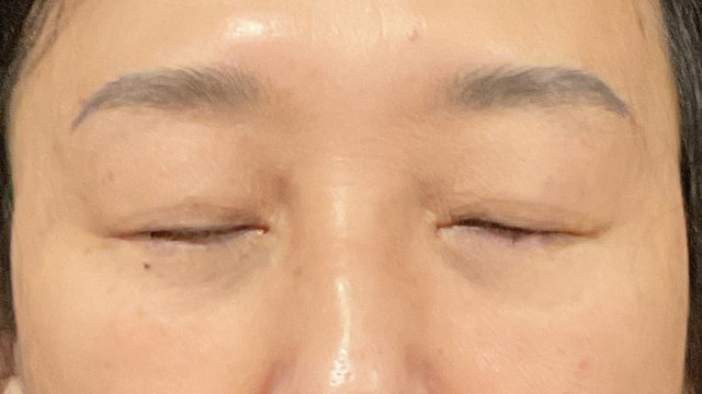 手术前的状态 其一