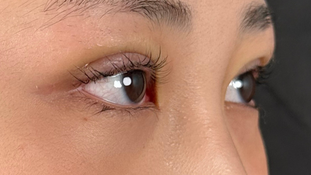 手术前的状态 其一