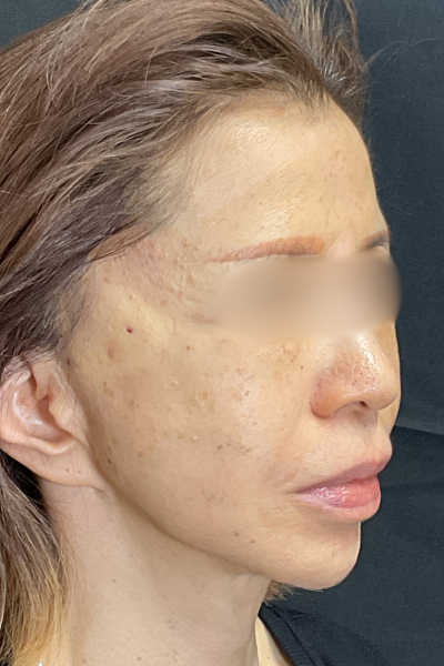 手術前の状態 その1