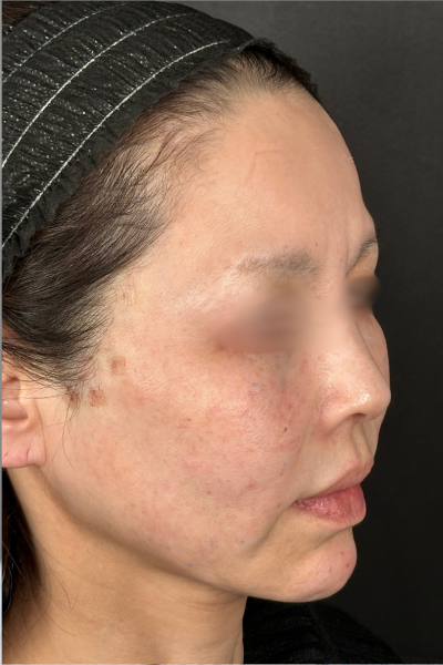 手術前の状態 その1