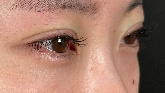 Postoperative Condition Part 1