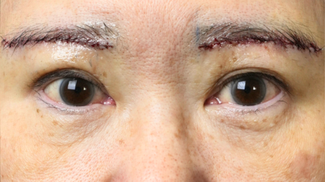 Postoperative Condition Part 1